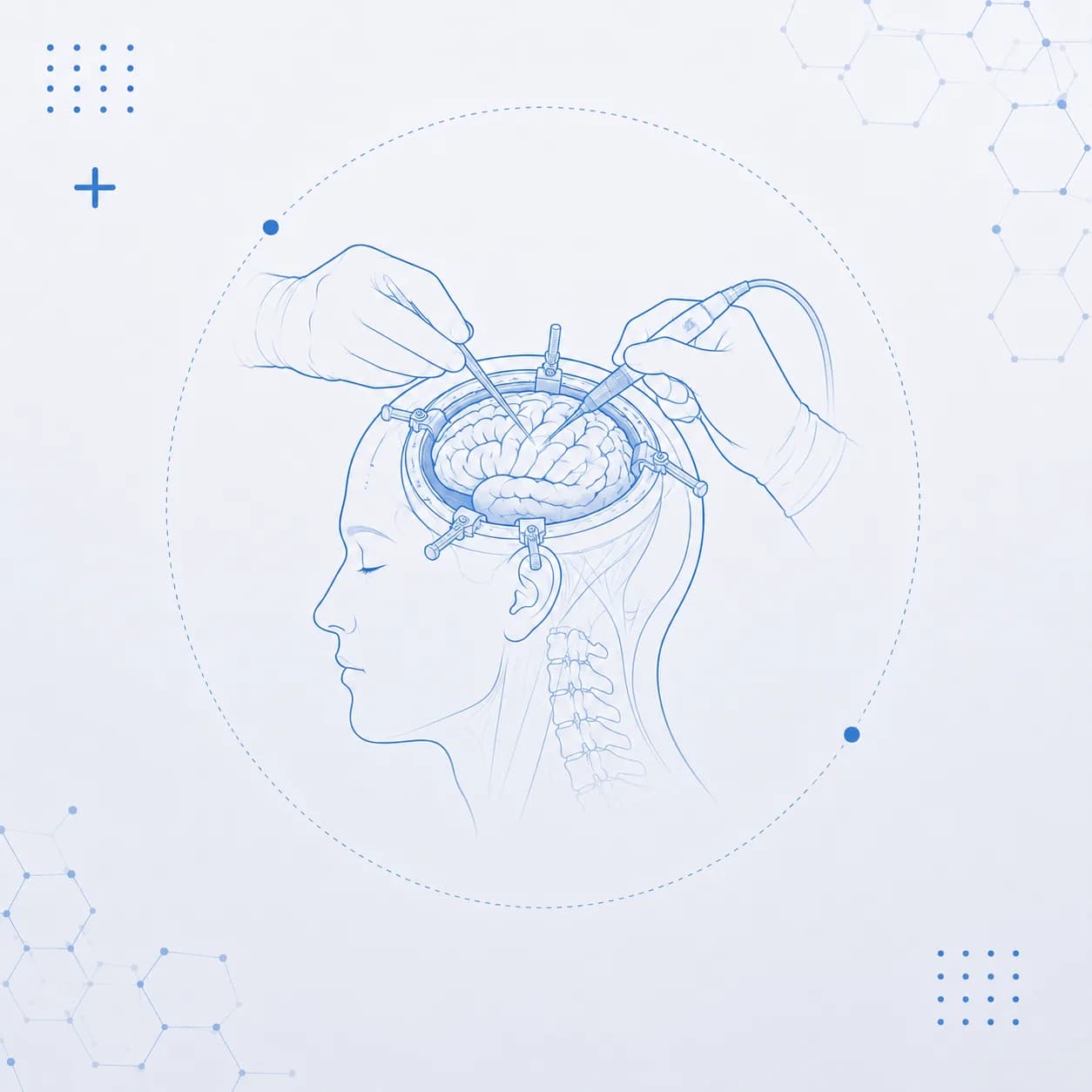 Neurocirurgia